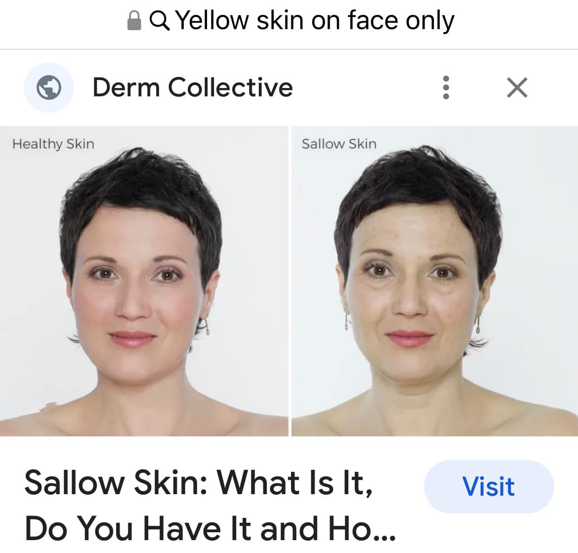 Can Skin Tone Change from Cool to Warm With Age  